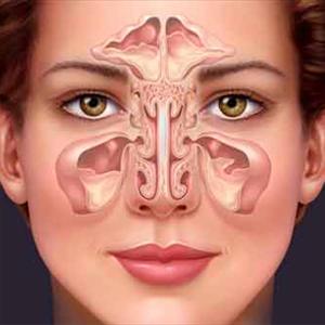 Fungus Sinusitis - How To Get Rid Of Sinus Congestion?