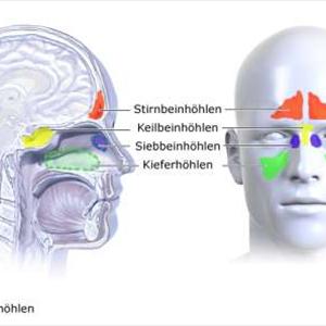 Relieve Sinus Congestion - How Can I Cure My Sinus?