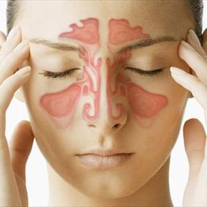 That Clear Sinuses - What Is Sinusitis?