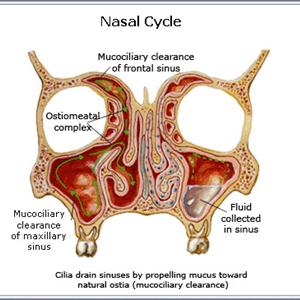  Sinus Pain, Sinusitis, And The Migraine Syndrome