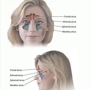 sinus pain ear enamel