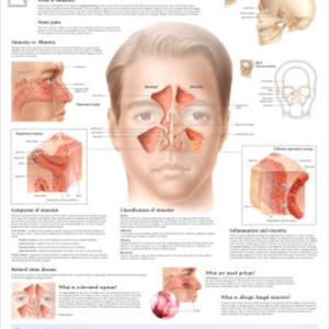  How To Tell If Your Headache And Sore Throat Is A Result Of Sinus